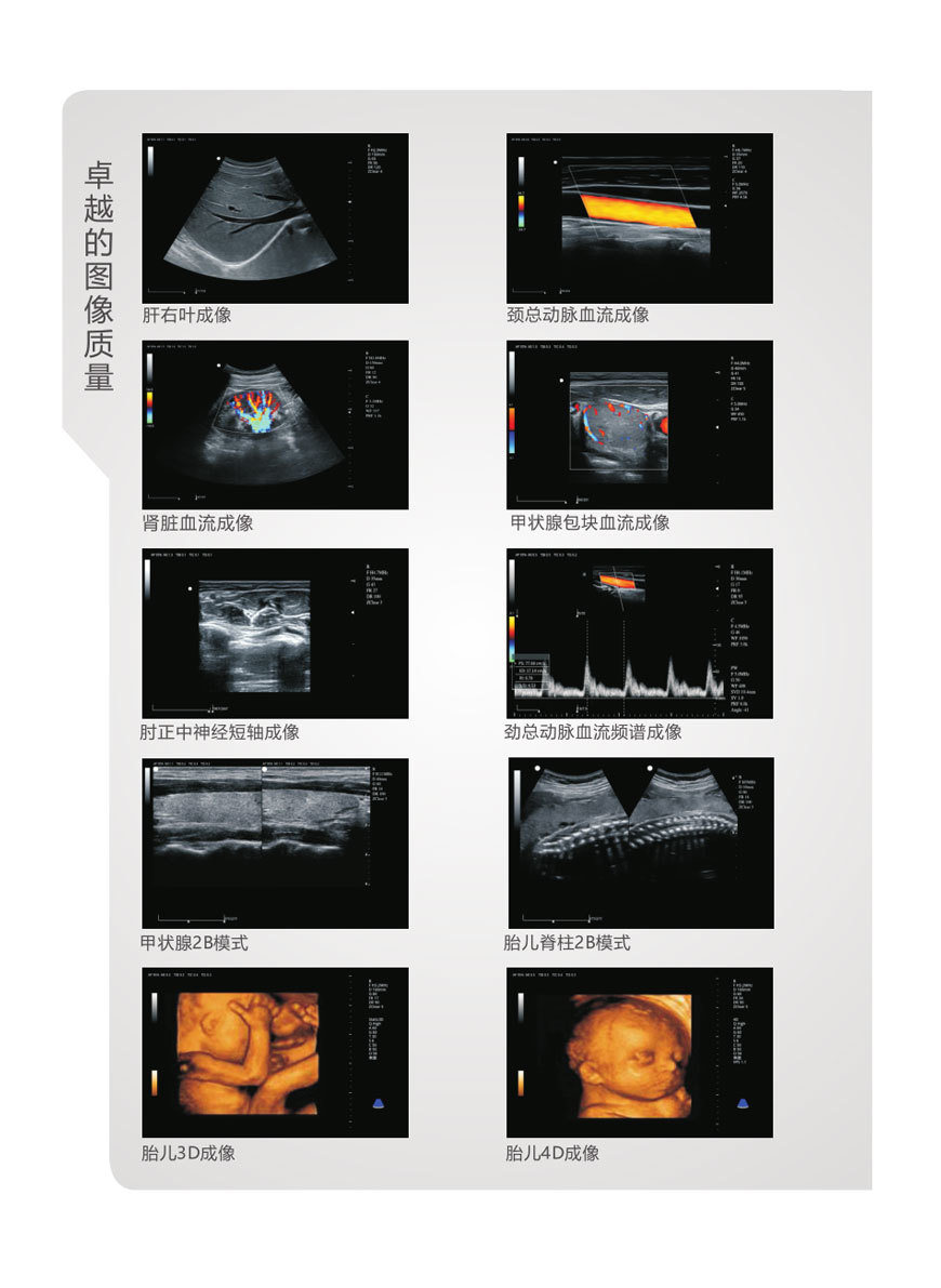 武汉中旗 全数字彩色多普勒超声诊断系统ZONCARE-S5